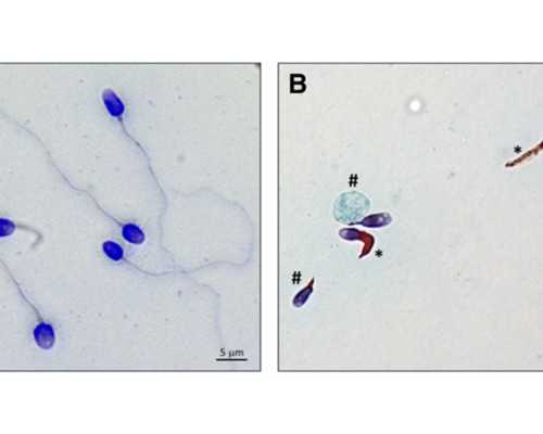40岁试管婴儿经历 学会这些少走弯路 少花钱 代孕最好公司